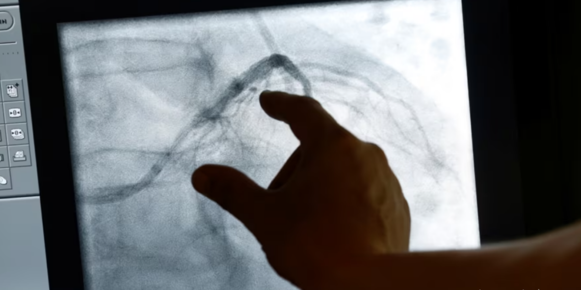 Diagnostikimi me inteligjencën artificiale i sëmundjeve të zemrës dhe kancerit