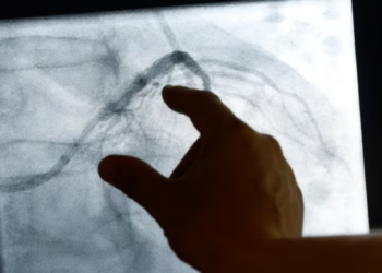 Diagnostikimi me inteligjencën artificiale i sëmundjeve të zemrës dhe kancerit