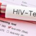 Raporti i HIV 2025: Shqipëria përballë një vale të re infeksionesh, rekord që nga 2016-a